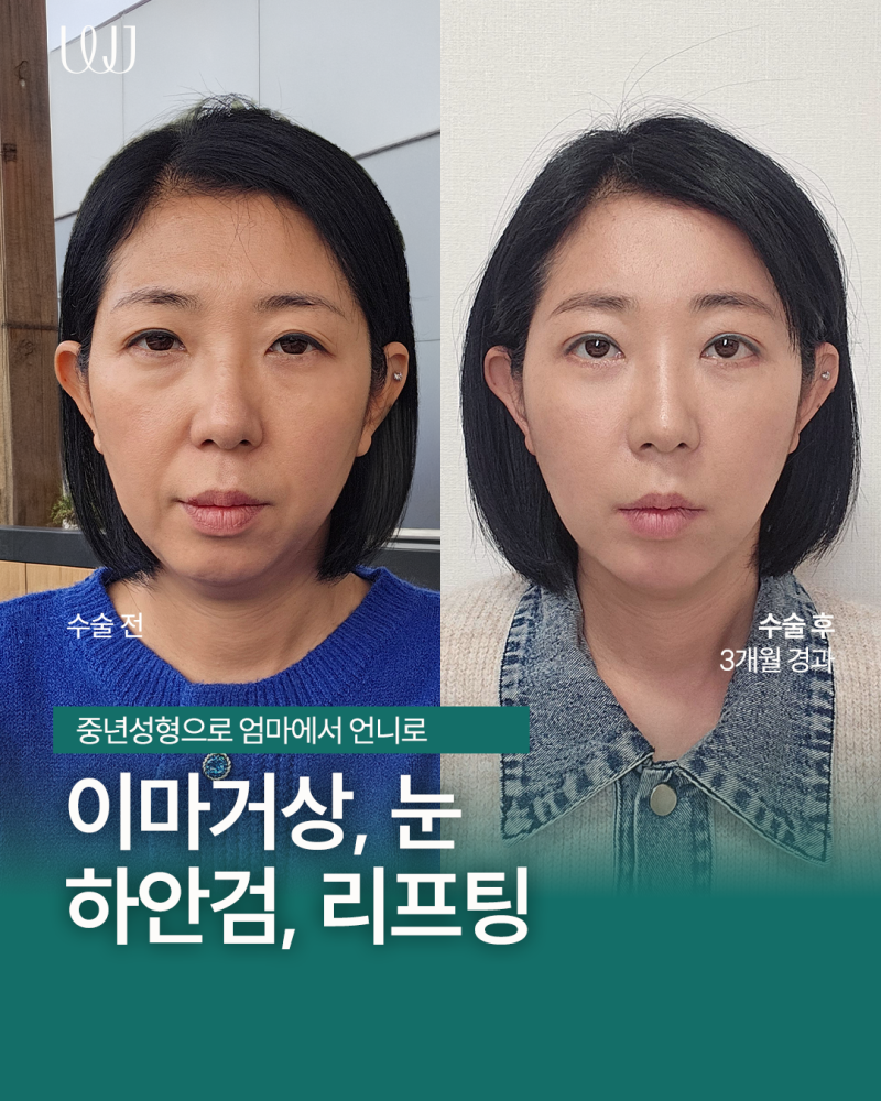 원진성형외과 커버 이미지